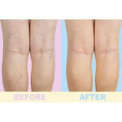Gel soin des jambes